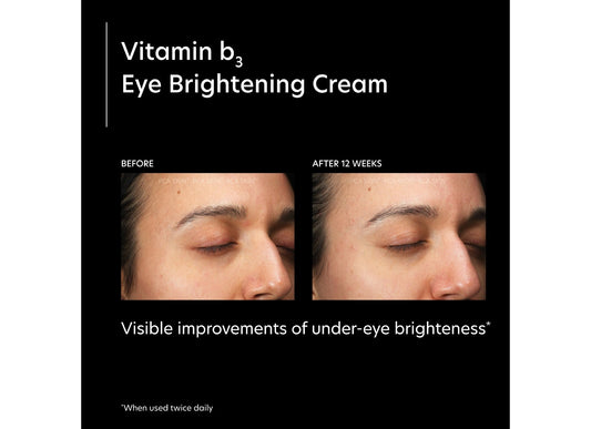Vitamin b3 Eye Brightening Cream